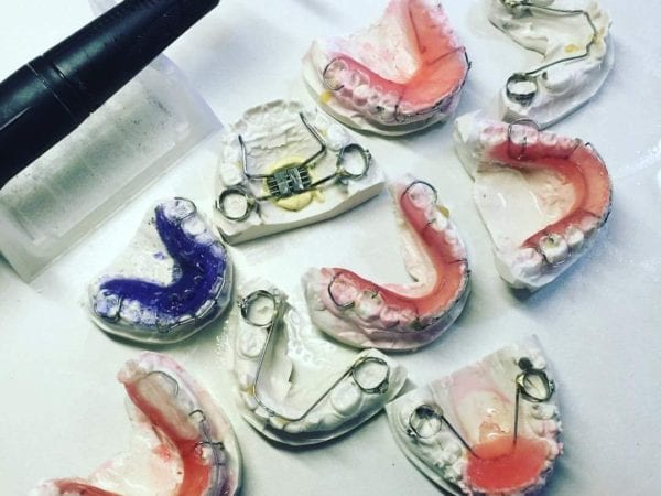 One of the really cool things about Fishbein Orthodontics – We Make our own orthodontic appliances!