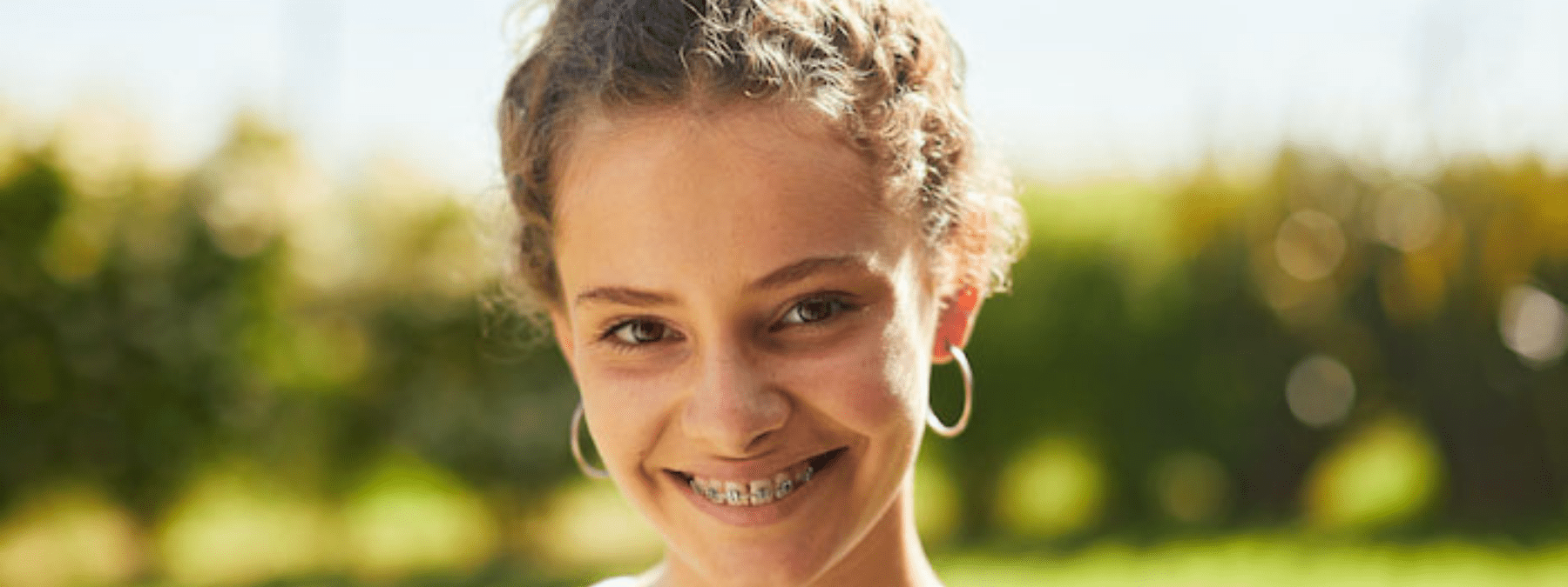 This Summer will be “No Sweat” with these braces tips