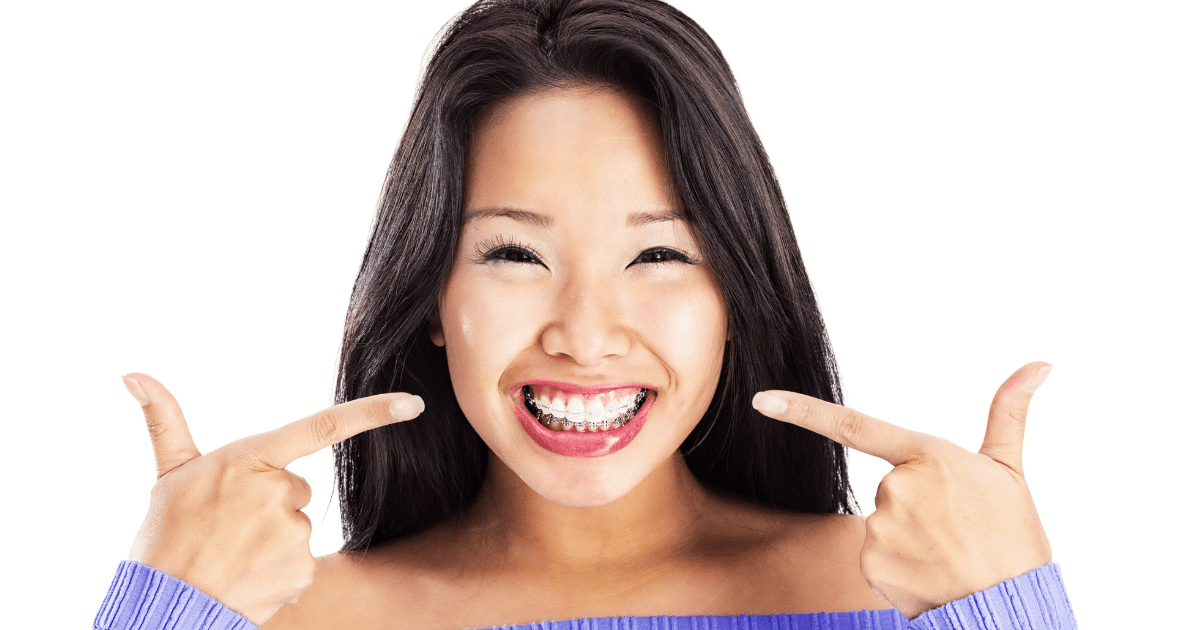 Clear Braces and Invisalign are Not the Same Thing!